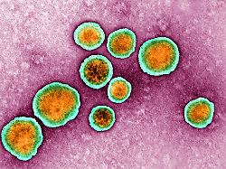 Furcht vor "Kinderklink-Füller": RKI sieht RSV-Welle anrollen