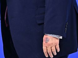 Bluterguss wegen "Friedensrat" : Weißes Haus nennt ungewöhnlichen Grund für Trumps blaue Hand