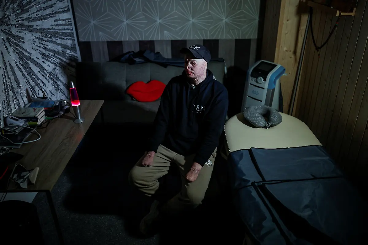 Ukrainian-soldier-Yehor-Babenko-27-a-member-of-the-Veterans-Theatre-group-sits-in-the-psychotherapy-room-at-the-Tytanovi-rehabilitation-center-where-he-works-as-a-veterans-psychologist-amid-Russia-s-attack-on-Ukraine-in-Kyiv-Ukraine-November-19-2025-Babenko-was-wounded-in-the-first-year-of-fighting-when-Russian-forces-struck-his-base-in-the-southern-region-of-Mykolaiv-but-that-did-not-stop-him-from-committing-to-months-of-taxing-rehearsals-full-of-dancing-twirling-and-tumbling-He-said-said-the-transformative-trauma-of-serious-injury-often-compels-people-to-seek-meaning-in-something-new-I-know-a-lot-of-cases-where-people-opened-up-or-tried-things-they-never-dared-to-try-REUTERS-Alina-Smutko-SEARCH-UKRAINE-SMUTKO-THEATRE-FOR-THIS-STORY-SEARCH-WIDER-IMAGE-FOR-ALL-STORIES