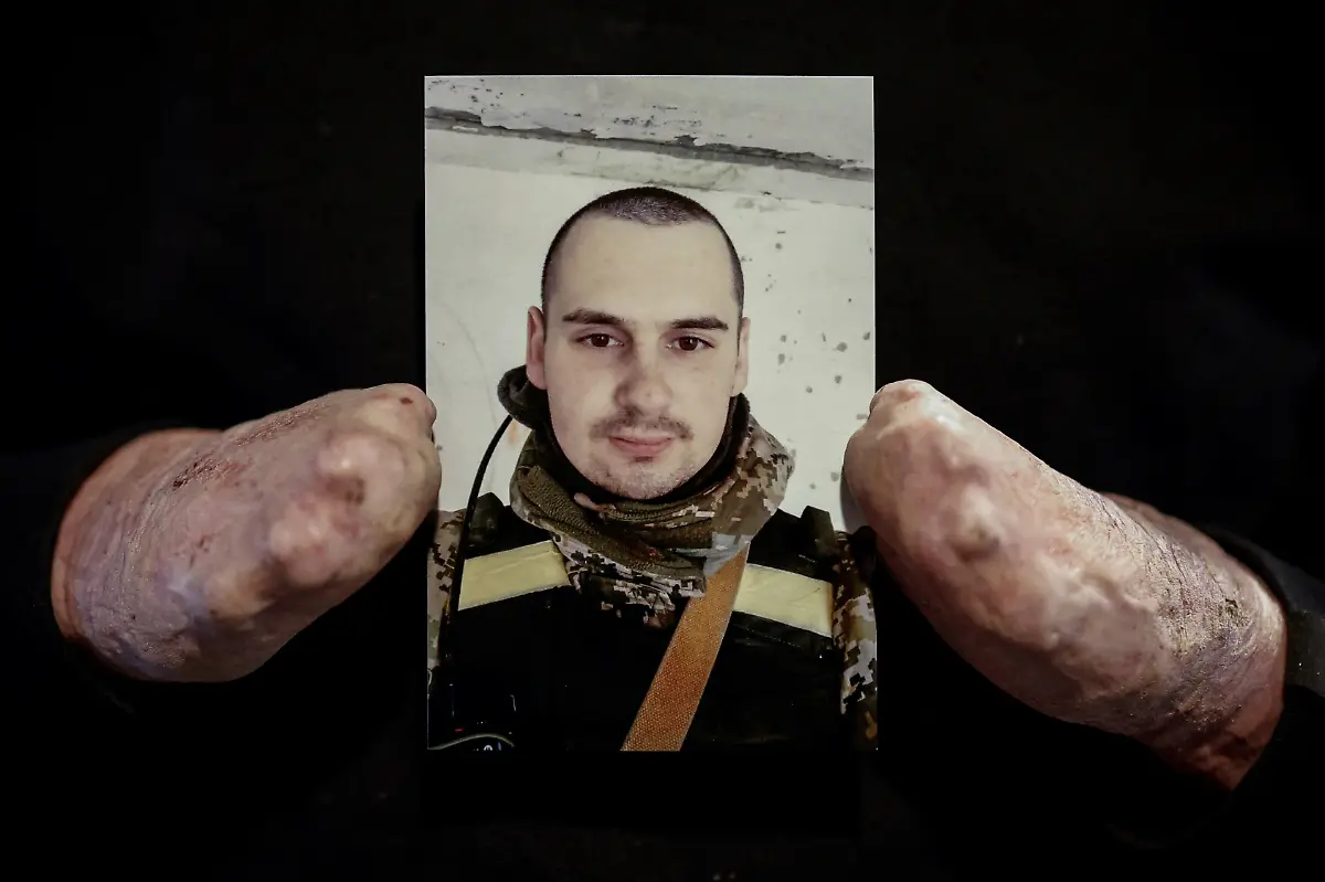 Ukrainian-soldier-Yehor-Babenko-27-a-member-of-the-Veterans-Theatre-group-holds-a-selfie-taken-before-he-was-wounded-at-the-Tytanovi-rehabilitation-center-where-he-works-as-a-veterans-psychologist-amid-Russia-s-attack-on-Ukraine-in-Kyiv-Ukraine-January-21-2026-Babenko-was-wounded-in-the-first-year-of-fighting-when-Russian-forces-struck-his-base-in-the-southern-region-of-Mykolaiv-but-that-did-not-stop-him-from-committing-to-months-of-taxing-rehearsals-full-of-dancing-twirling-and-tumbling-He-said-said-the-transformative-trauma-of-serious-injury-often-compels-people-to-seek-meaning-in-something-new-I-know-a-lot-of-cases-where-people-opened-up-or-tried-things-they-never-dared-to-try-REUTERS-Alina-Smutko-SEARCH-UKRAINE-SMUTKO-THEATRE-FOR-THIS-STORY-SEARCH-WIDER-IMAGE-FOR-ALL-STORIES-NO-RESALES