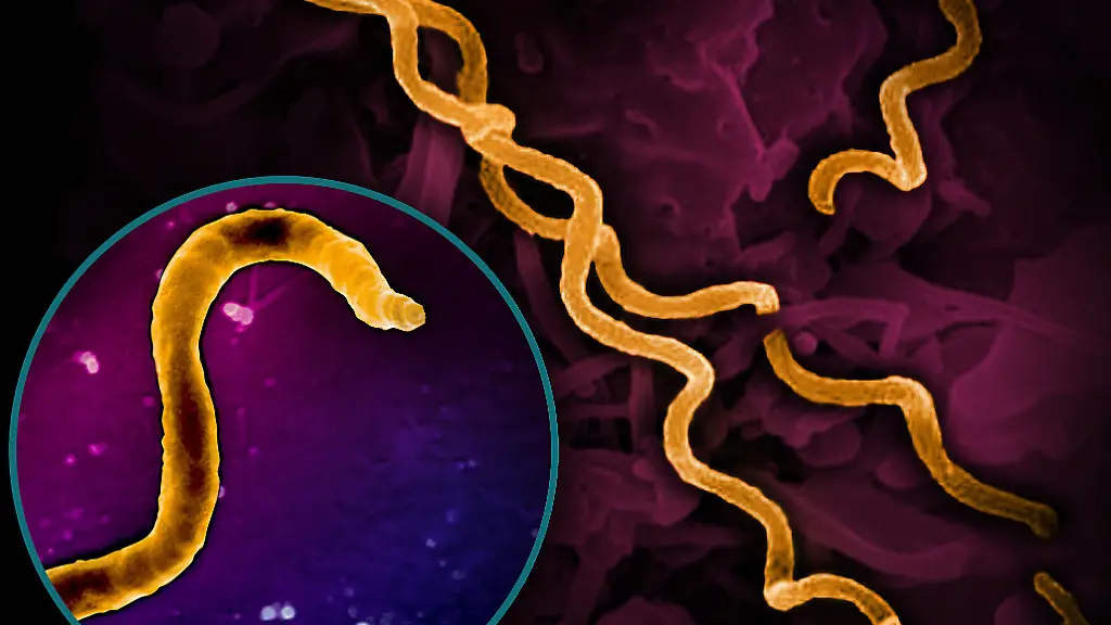 Electron-micrograph-imagery-of-Treponema-pallidum-the-bacteria-that-cause-syphilis-including-a-foreground-close-up-of-a-single-particle-Spiral-shaped-bacteria-are-colorized-in-gold