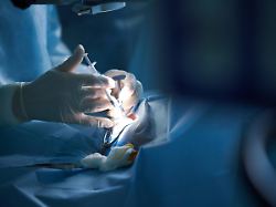 Diamantenhändler gestorben: Chirurgen verlieren Zulassung nach Tod bei Penisvergrößerung