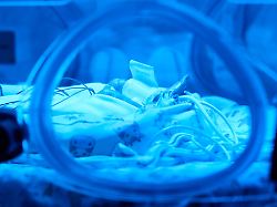 Bayern: Hoffnung für Frühchen: KI-Modellprojekt in Nürnberg startet