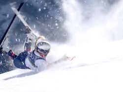 Um Komplikationen zu verhindern: Bericht: Lindsey Vonn musste zweimal operiert werden