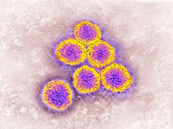 Gefahr für Deutschland wächst: Tropenvirus breitet sich in Österreich aus