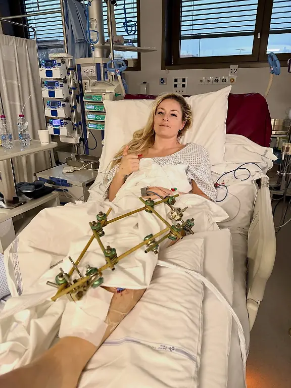 U-S-skier-Lindsey-Vonn-lies-in-a-hospital-bed-after-she-crashed-during-the-Women-s-Downhill-in-Treviso-Italy-in-this-picture-obtained-from-social-media-on-February-11-2026-lindseyvonn-via-Instagram-via-REUTERS-THIS-IMAGE-HAS-BEEN-SUPPLIED-BY-A-THIRD-PARTY-MANDATORY-CREDIT-NO-RESALES-NO-ARCHIVES