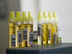 Fortpflanzungsschädigender Stoff: Fast alle Urin-Proben von Heranwachsenden sind belastet