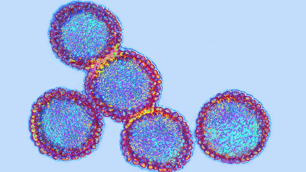 Influenza-virus-Viruses-of-the-Orthomyxoviridae-family-Avian-plague-virus-The-flu-virus-is-the-cause-of-an-infectious-and-contagious-respiratory-disease-It-evolves-into-a-major-pandemic-interspersed-with-small-localized-seasonal-epidemics-Virus-diameter-about-100-nm-Computer-graphics-on-transmission-electron-microscope-view