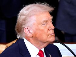 Arzt schweigt über Gründe: Riesiger roter Fleck an Trumps Hals befeuert Spekulationen