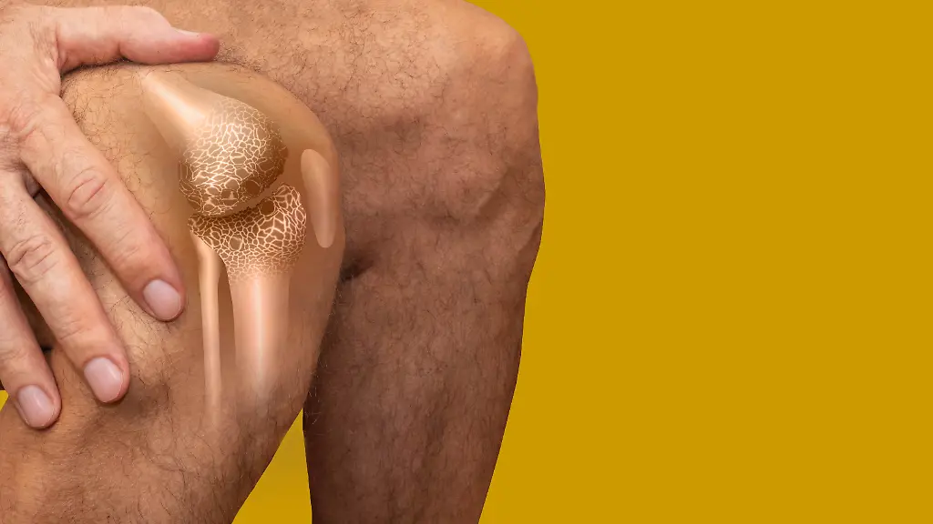 Acute-pain-in-a-knee-joint-close-up-Color-image-isolated-on-a-pastel-background-Pain-area-of-red-color-Acute-pain-in-a-knee-joint-close-up-Color-image-isolated-on-a-pastel-background-Pain-area-of-red-color-Senior-man-holding-the-knee-with-pain-Collage-Acute-pain-in-a-knee-joint-close-up-Color-image-isolated-on-a-pastel-background-Pain-area-of-red-color-Senior-man-holding-the-knee-with-pain-Collage-26-01-2024-Copyright-xmarina13x-Panthermedia36552934