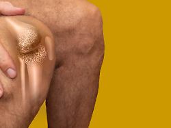 Unabhängig vom Gewichtsverlust: Wirkstoff in Abnehmspritzen könnte Arthrose lindern