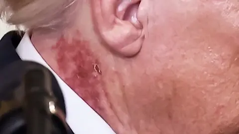 Trump_Fleck