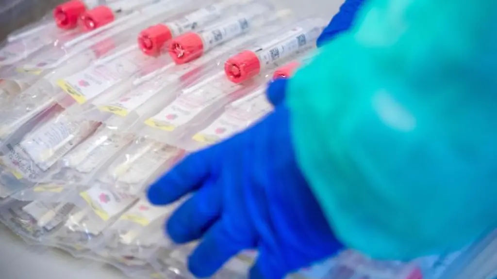 Testsets-mit-Abstrichstaebchen-liegen-in-einem-Testzentrum-fuer-Corona-Verdachtsfaelle