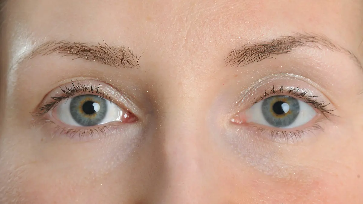 Nebenwirkung nach Abnehmspritze: Was verbirgt sich hinter einem Augeninfarkt?