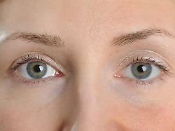 Nebenwirkung nach Abnehmspritze: Was verbirgt sich hinter einem Augeninfarkt?