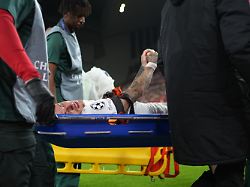 Teil des Fingers verloren?: Galatasaray fordert nach Noa Langs seltsamer Verletzung Schadenersatz