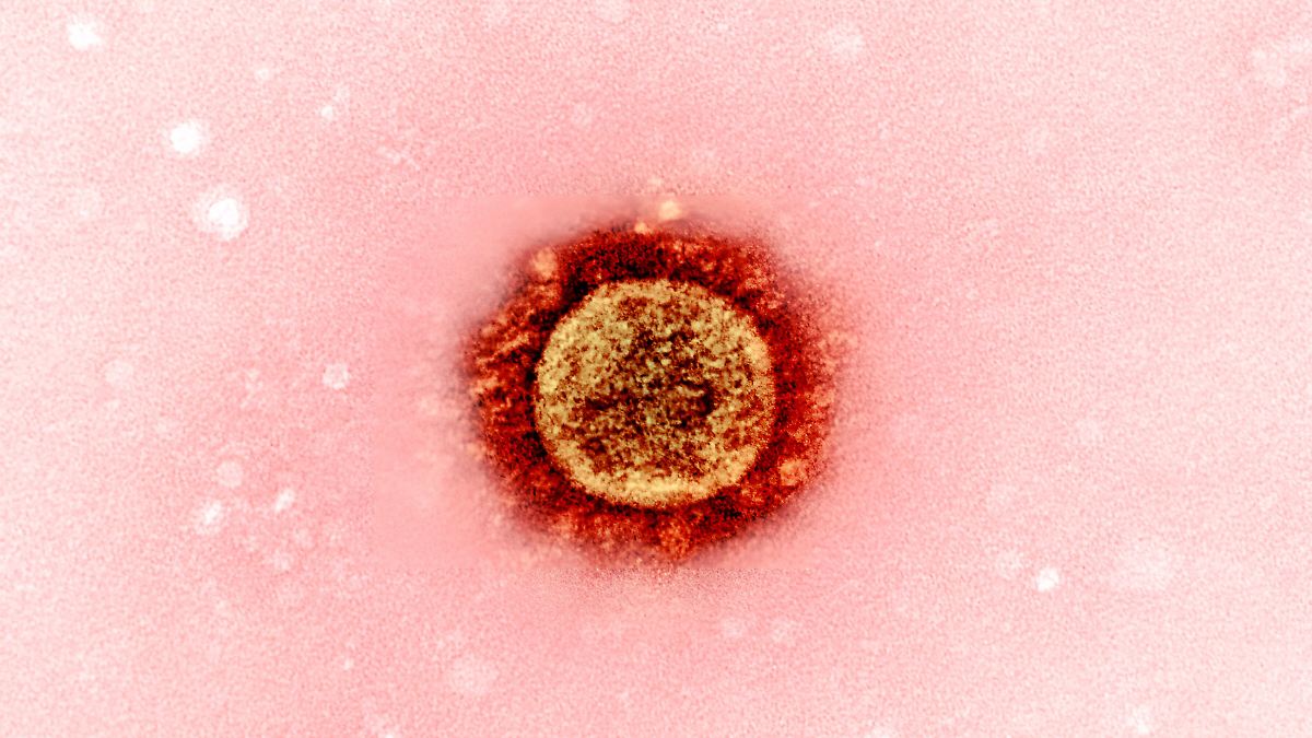 Viren springen ohne besondere Mutationen auf Menschen über