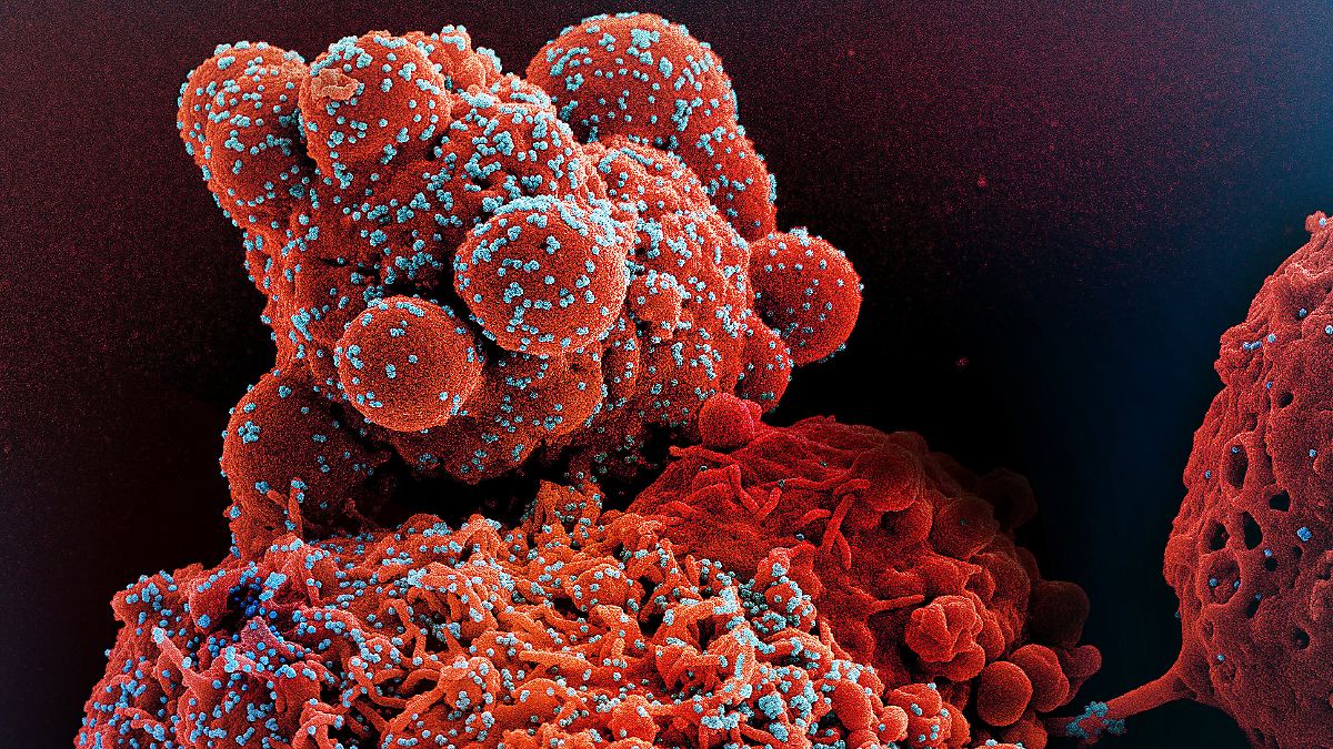 Lange Zeit unter dem Radar : Neue Corona-Variante "Cicada" breitet sich aus