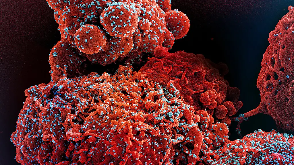 Colorized-scanning-electron-micrograph-of-a-cell-red-infected-with-the-Omicron-strain-of-SARS-CoV-2-virus-particles-blue-isolated-from-a-patient-sample