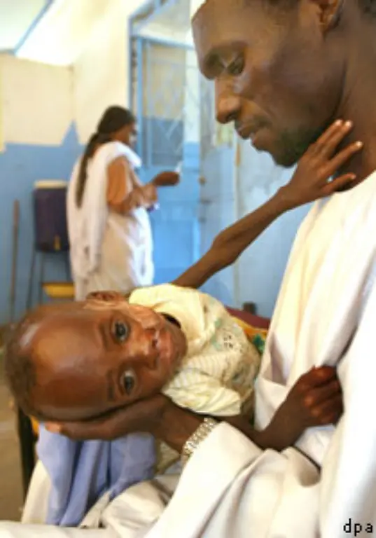 Die-Organisation-Aerzte-ohne-Grenzen-erinnert-nun-an-10-vergessene-Krisenherde-des-Jahres-2005