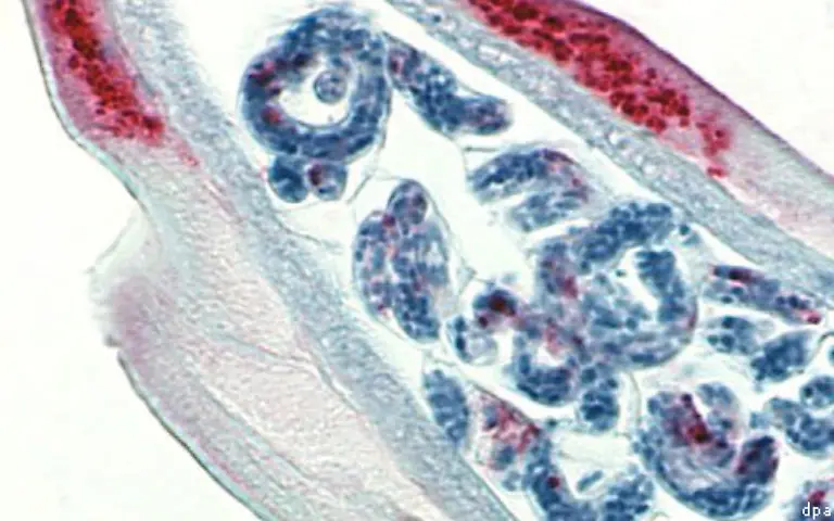 Die-1980er-Jahre-waren-jedoch-auch-die-Hochzeit-tatsaechlicher-Lebensmittel-Skandale-Das-ARD-Magazin-Monitor-berichtet-1987-ueber-Larven-von-Fadenwuermern-in-Fischen