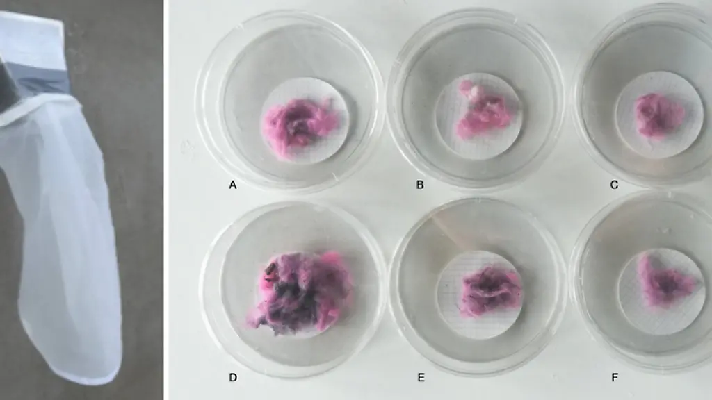 ACHTUNG-Nur-zur-redaktionellen-Verwendung-im-Zusammenhang-mit-der-aktuellen-Berichterstattung
