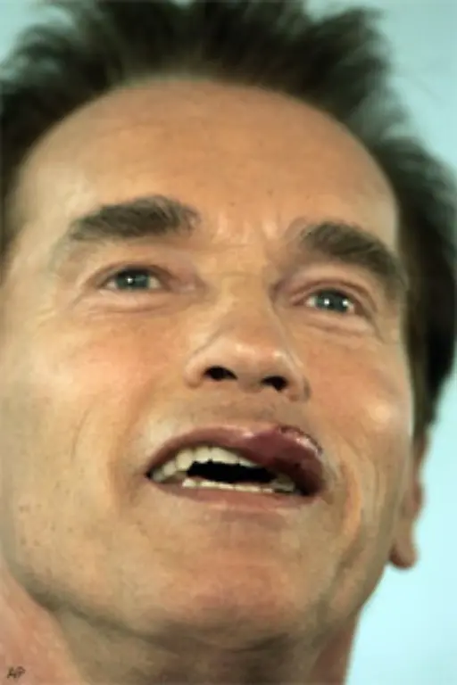 Zu-Boden-ging-er-im-Januar-2006-mit-seinem-Motorrad-Folge-war-unter-anderem-eine-Verletzung-an-der-Lippe