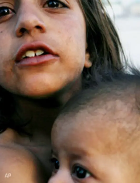 Viele-Kinder-muessen-hungern-und-werden-in-einer-Welt