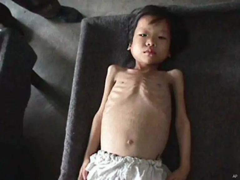 Grosse-Teile-der-Bevoelkerung-litten-Hunger-Viele-Menschen-fanden-in-diesen-Jahren-den-Tod