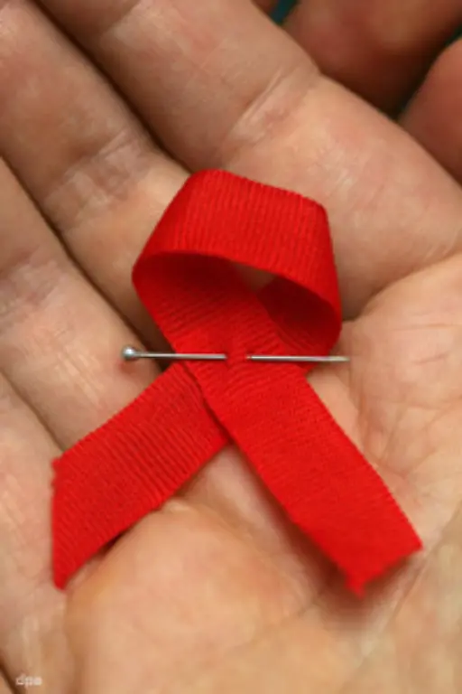 Unter-dem-Symbol-der-roten-Schleife-lenkt-der-Welt-AIDS-Tag-jeweils-am-1-Dezember-die-Aufmerksamkeit-auf-die-Opfer-von-HIV