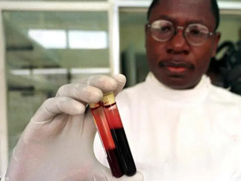 In-jeder-Minuten-infizieren-sich-etwa-zehn-Menschen-neu