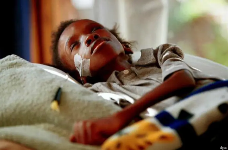 In-den-naechsten-zehn-Jahren-rechnen-Experten-mit-50-Millionen-Neuinfektionen