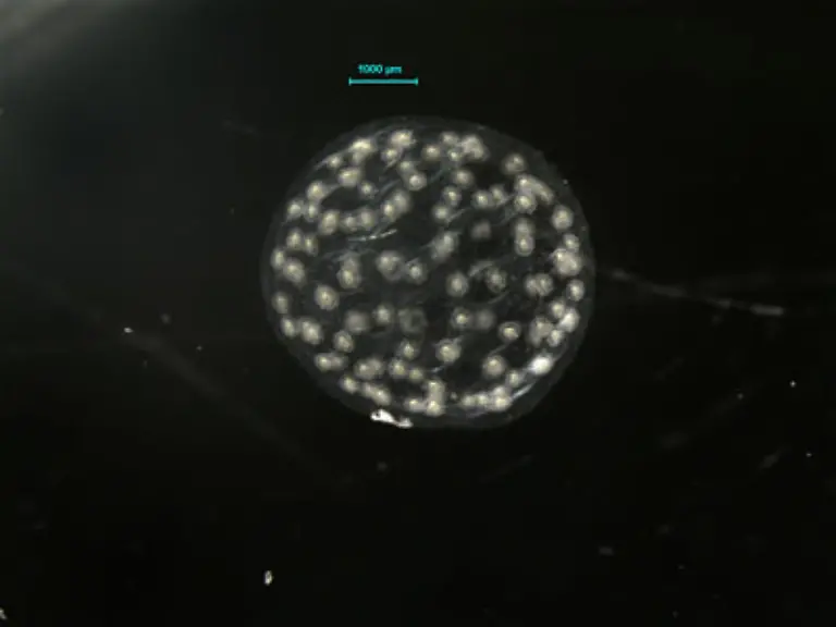 Radiolarian