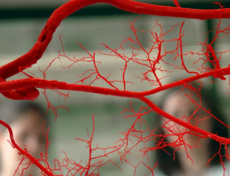 Denn-durch-Bluthochdruck-kann-es-zur-gefaehrlichen-Arteriosklerose-kommen