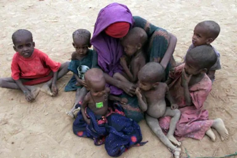 Hunger-und-Unterernaehrung-sind-afrikanischer-Alltag