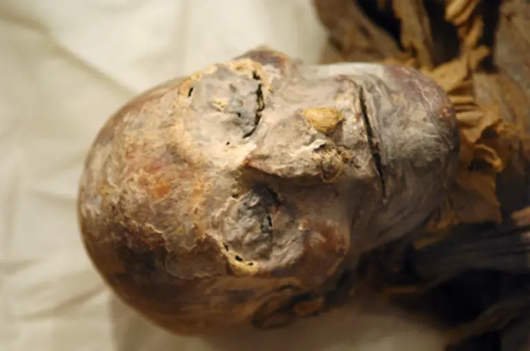 Der-Backenzahn-passe-laut-Computertomografie-eindeutig-in-die-Zahnluecke-der-Mumie-Auch-die-genetischen-Vergleiche-ergaben-eine-Uebereinstimmung-erklaerte-Zahi-Hawas-Chef-der-aegyptischen-Altertuemer-Verwaltung-auf-einer-Pressekonferenz