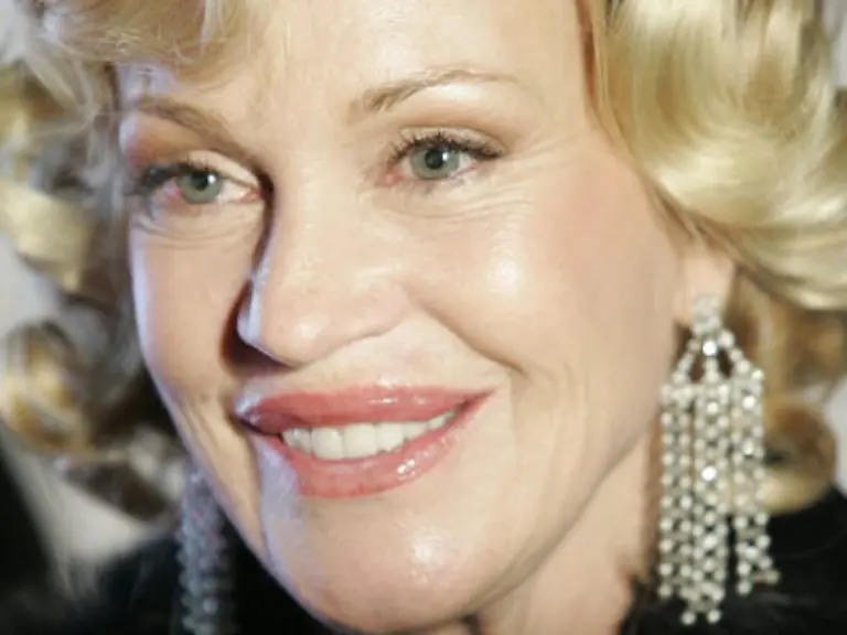 Mit-24-wurde-sie-bei-Dreharbeiten-zu-Roar-von-einer-Raubkatze-angefallen-Ihr-Gesicht-musste-mit-50-Stichen-genaeht-werden