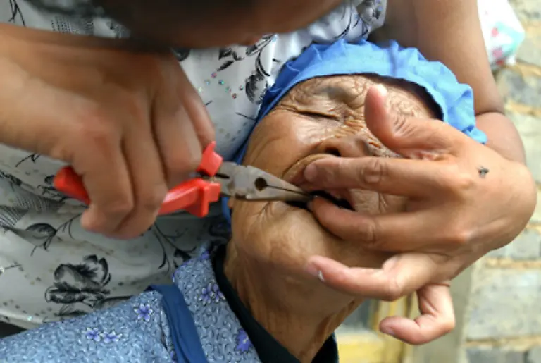 jemandem-einen-Zahn-ziehen-oder