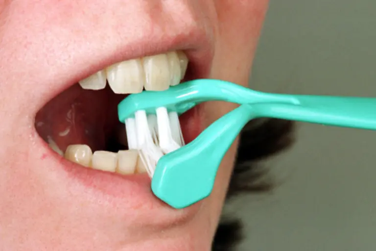 oder-bessser-unter-die-Buerste-genommen-und-geputzt-werden