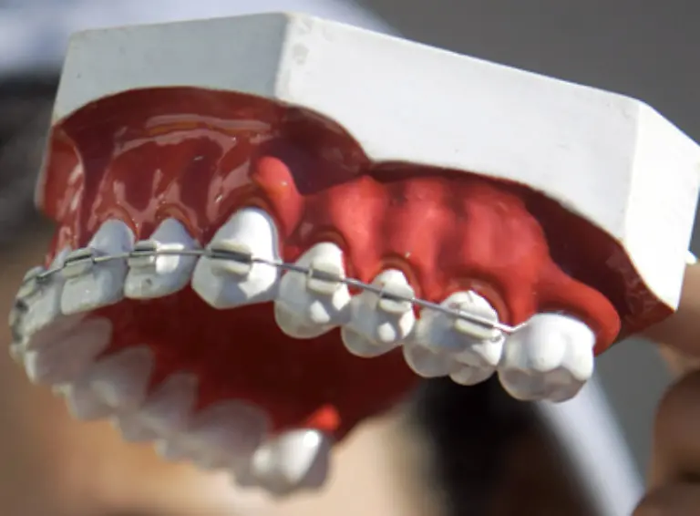 denn-in-jedem-Alter-koennen-solche-Fehlstellungen-mittels-einer-festen