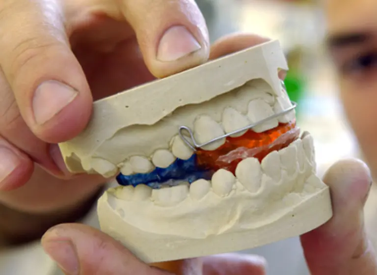 oder-einer-herausnehmbaren-Zahnspange-korrigiert-werden-Mit-mechanischem-Druck-und-Zug-veraendert-eine-Zahnspangen-die-Lage-der-Zaehne-so-dass-die-Bisskraft-im-Mund-wieder-optimal-verteilt-ist