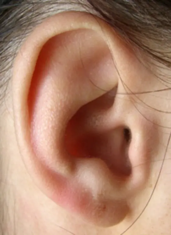 Die-Ohren-der-ersten-Menschen-waren-nicht-nur-drehbar-sondern-hatten-auch-ein-spitze-Form-Die-Reste-der-Spitze-findet-man-noch-am-Aussenrand-der-Ohrmuschel-Der-knorpelige-Fortsatz-heisst-Darwin-Ohrhoecker