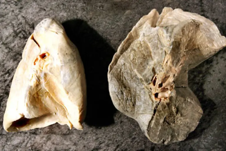 Nichtraucherlunge-und-Raucherlunge-Der-Teer-ein-zaehfluessiges-schwarzbraunes-Kohlenwasserstoffgemisch-das-als-Rueckstand-bei-der-Verbrennung-von-Tabak-entsteht-lagert-sich-kontinuierlich-in-der-Lunge-ab-Die-Lungenfunktion-wird-zunehmend-eingeschraenkt