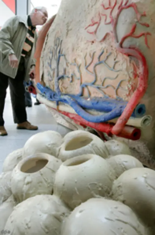 Ob-das-Rauchen-Ausloeser-von-Prostatakrebs-sein-kann-im-Bild-ein-Prostata-Modell-ist-umstritten-Eine-US-Studie-mit-450-000-Maennern-ergab-allerdings-dass-die-Todesrate-von-rauchenden-Prostatapatienten-deutlich-hoeher-ist