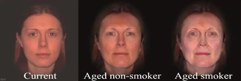 Die-Haut-von-Rauchern-altert-schneller-Im-Bild-ein-weiterer-Abschreckungs-Versuch-Mittels-Computer-Simulation-wird-der-Hautalterungsprozess-einer-Raucherin-r-und-einer-Nichtraucherin-M-dargestellt