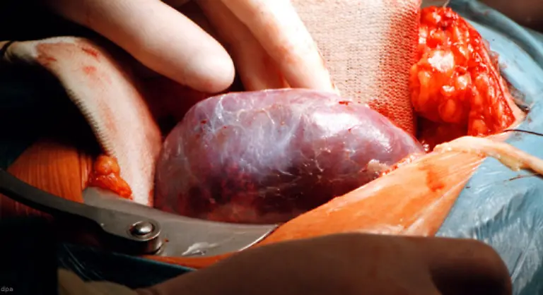 Rauchen-schaedigt-auch-Niere-und-Leber