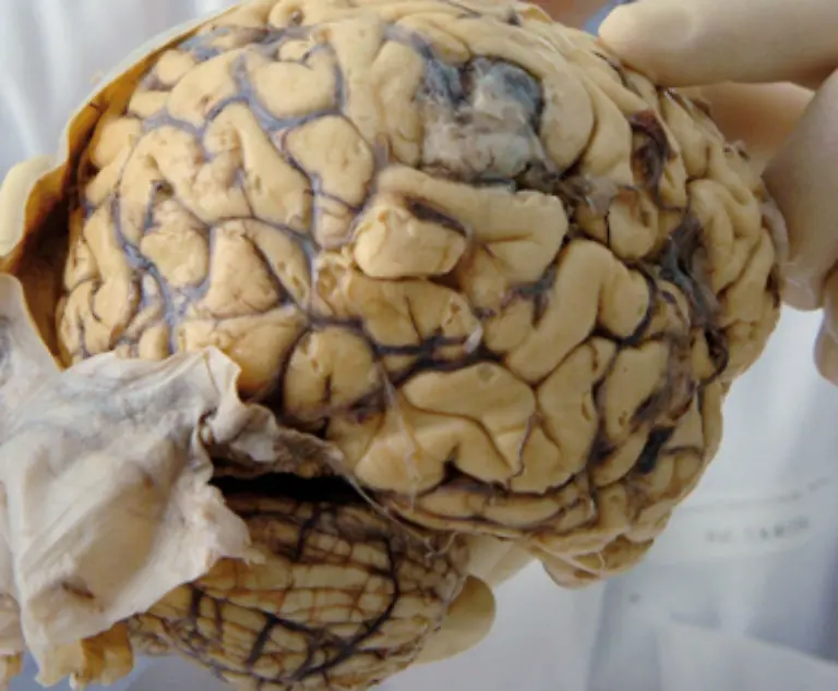 Im-Gehirn-werden-die-Reize-aller-Sinne-zu-einem-sinnvollen-Ganzen-zusammen-getragen