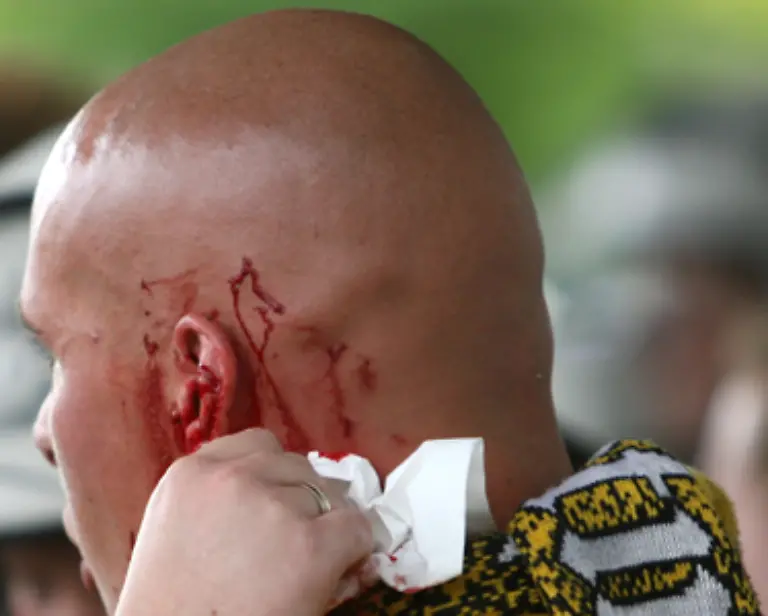 Das-gesamte-Hoersystem-ist-die-Ohren-eingeschlossen-sehr-sensibel