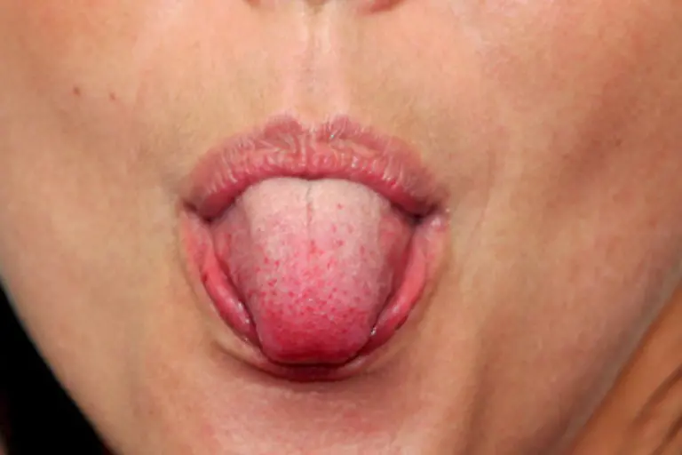 Verantwortlich-fuer-den-Geschmackssinn-sind-die-Geschmacksrezeptoren-auf-der-Oberseite-der-Zunge-Die-Geschmaecke-die-unabhaengig-vom-Geruch-sind-lassen-sich-in-fuenf-Grundqualitaeten-einteilen