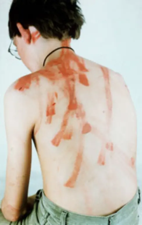 Allein-in-den-OECD-Laendern-sterben-jedes-Jahr-3-500-Kinder-an-den-Folgen-von-Misshandlungen-und-Vernachlaessigung